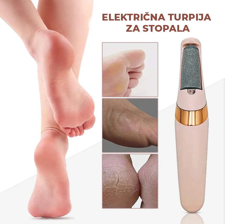 Električna turpija za pete – glatka stopala bez odlaska u salon